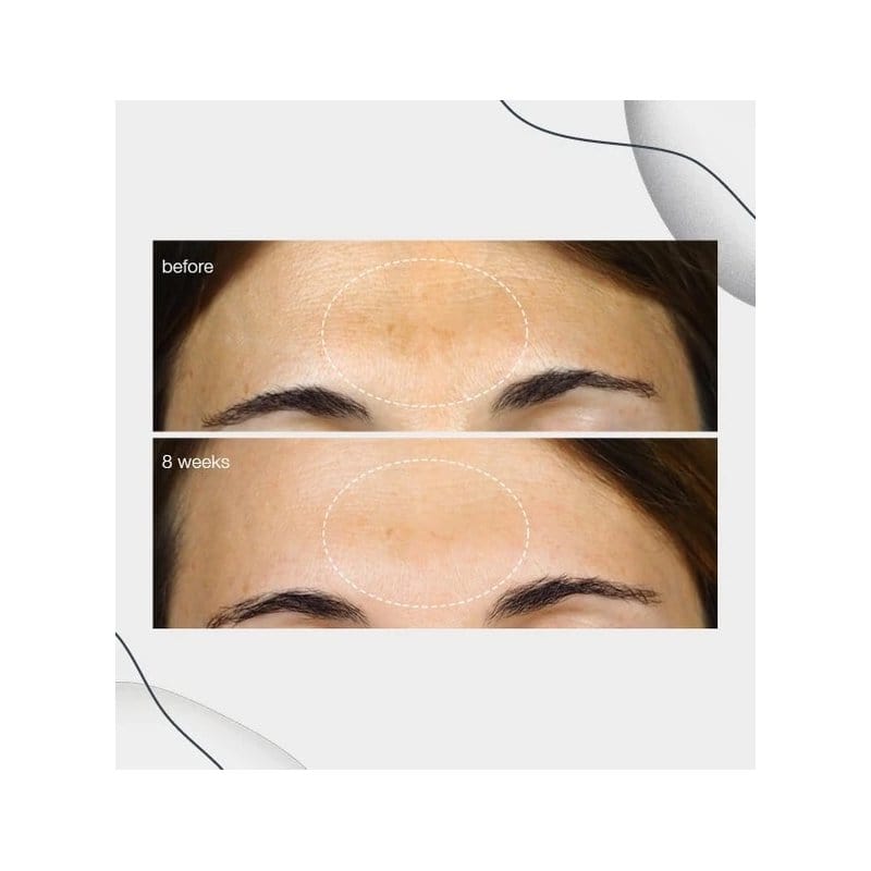 Dermalogica Powerbright Dark Spot Serum 30 ml